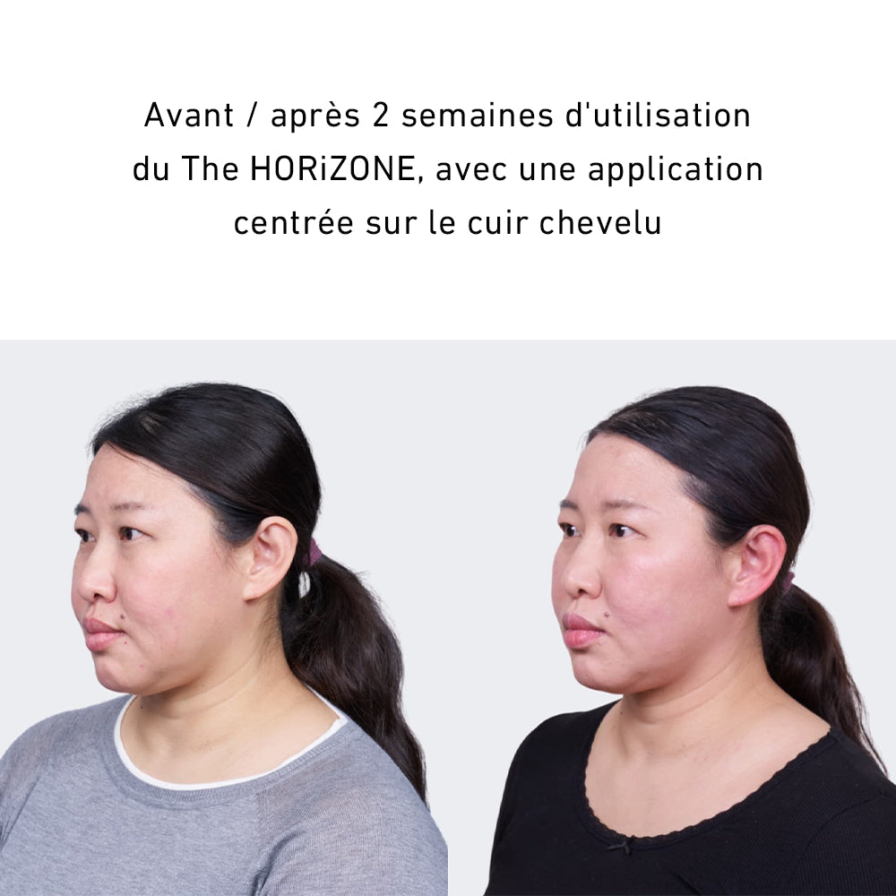 HORiZONE