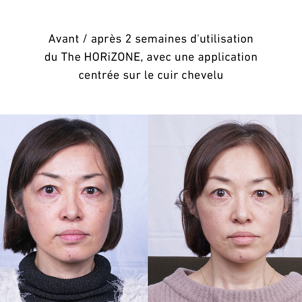 HORiZONE